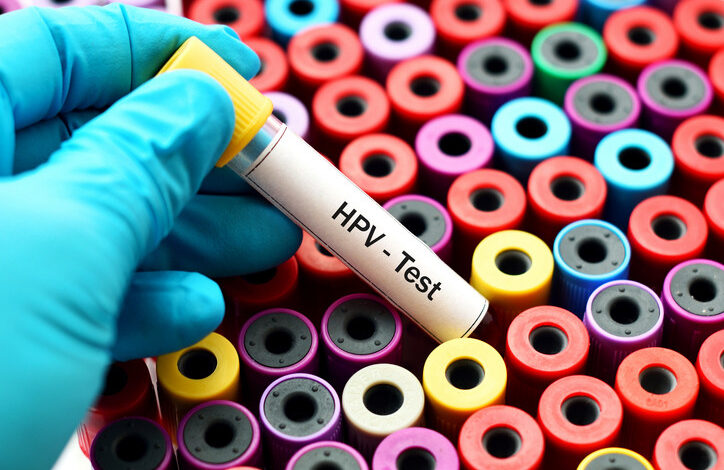 hpv test